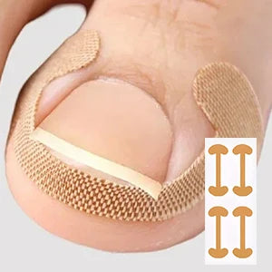 At Home Ingrown Toenail Corrector Strips Pedicure Kit