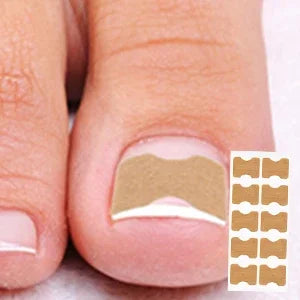 At Home Ingrown Toenail Corrector Strips Pedicure Kit