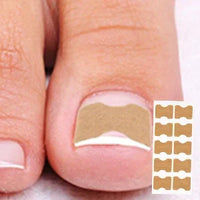 At Home Ingrown Toenail Corrector Strips Pedicure Kit