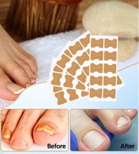 At Home Ingrown Toenail Corrector Strips Pedicure Kit