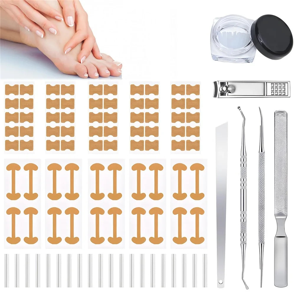 At Home Ingrown Toenail Corrector Strips Pedicure Kit